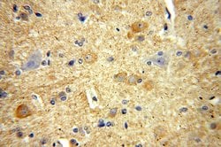 RPL19 Rabbit anti-Human, Mouse, Rat, Polyclonal, Proteintech 150 &mu;L;