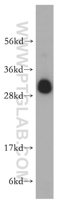 RPL19 Rabbit anti-Human, Mouse, Rat, Polyclonal, Proteintech 150 &mu;L;
