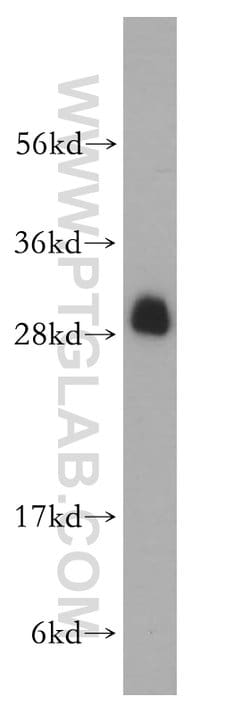 RPL19 Rabbit anti-Human, Mouse, Rat, Polyclonal, Proteintech 150 &mu;L;