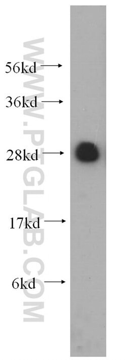 RPL19 Rabbit anti-Human, Mouse, Rat, Polyclonal, Proteintech 150 &mu;L;