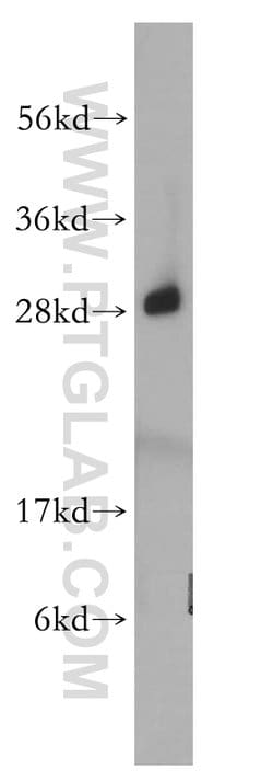 RPL19 Rabbit anti-Human, Mouse, Rat, Polyclonal, Proteintech 150 &mu;L;