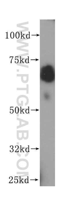 PAPSS1 Rabbit anti-Human, Mouse, Rat, Polyclonal, Proteintech 20 &mu;L;