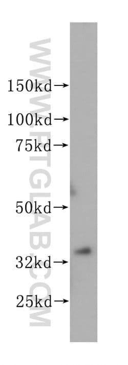 PEX19 Rabbit anti-Human, Mouse, Rat, Polyclonal, Proteintech 150 &mu;L;