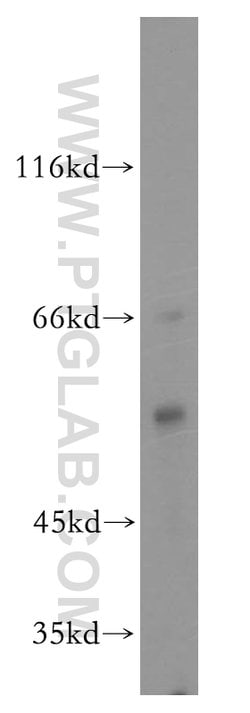 MPP1 Rabbit anti-Human, Mouse, Rat, Polyclonal, Proteintech:Antibodies:Primary