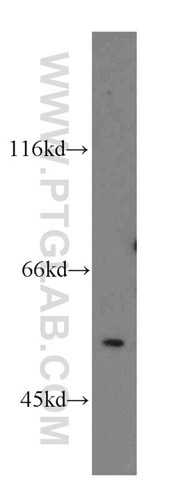 MPP1 Rabbit anti-Human, Mouse, Rat, Polyclonal, Proteintech:Antibodies:Primary