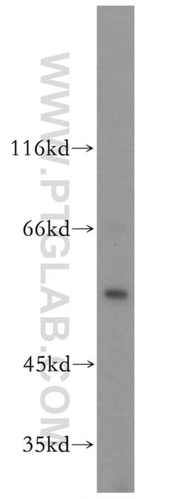MPP1 Rabbit anti-Human, Mouse, Rat, Polyclonal, Proteintech:Antibodies:Primary