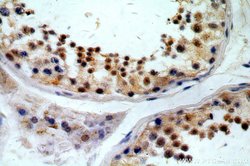 KLF6 Rabbit anti-Human, Mouse, Rat, Polyclonal, Proteintech 150 &mu;L;