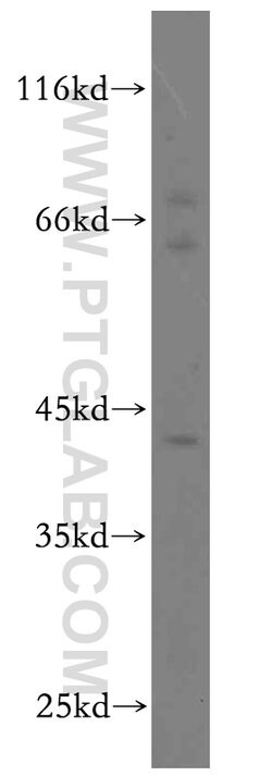 KLF6 Rabbit anti-Human, Mouse, Rat, Polyclonal, Proteintech 150 &mu;L;