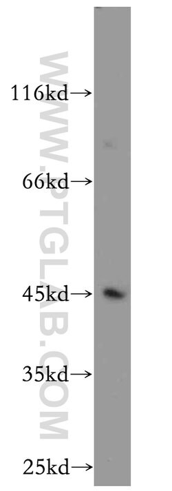 KLF6 Rabbit anti-Human, Mouse, Rat, Polyclonal, Proteintech 150 &mu;L;