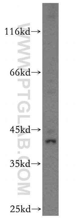 KLF6 Rabbit anti-Human, Mouse, Rat, Polyclonal, Proteintech 150 &mu;L;