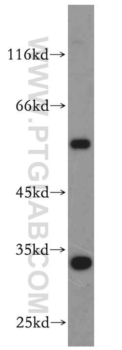 KLF6 Rabbit anti-Human, Mouse, Rat, Polyclonal, Proteintech 150 &mu;L;