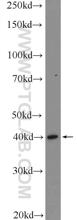 KLF6 Rabbit anti-Human, Mouse, Rat, Polyclonal, Proteintech 150 &mu;L;