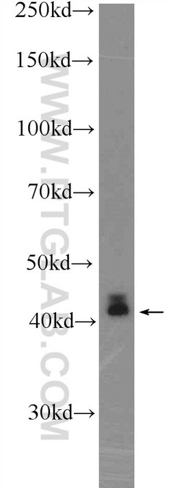 KLF6 Rabbit anti-Human, Mouse, Rat, Polyclonal, Proteintech 150 &mu;L;