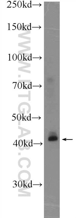 KLF6 Rabbit anti-Human, Mouse, Rat, Polyclonal, Proteintech 150 &mu;L;