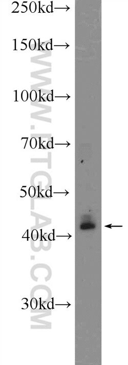 KLF6 Rabbit anti-Human, Mouse, Rat, Polyclonal, Proteintech 150 &mu;L;