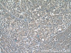 PGD Rabbit anti-Human, Mouse, Rat, Polyclonal, Proteintech 150 &mu;L; Unconjugated:Antibodies,