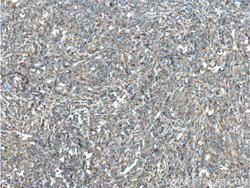 PGD Rabbit anti-Human, Mouse, Rat, Polyclonal, Proteintech 150 &mu;L; Unconjugated:Antibodies,