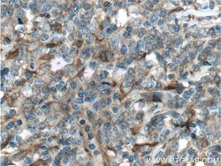 PGD Rabbit anti-Human, Mouse, Rat, Polyclonal, Proteintech 150 &mu;L; Unconjugated:Antibodies,