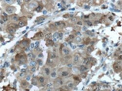 PGD Rabbit anti-Human, Mouse, Rat, Polyclonal, Proteintech 150 &mu;L; Unconjugated:Antibodies,