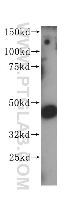 PGD Rabbit anti-Human, Mouse, Rat, Polyclonal, Proteintech 150 &mu;L; Unconjugated:Antibodies,