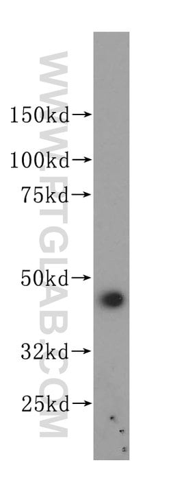 PGD Rabbit anti-Human, Mouse, Rat, Polyclonal, Proteintech 150 &mu;L; Unconjugated:Antibodies,