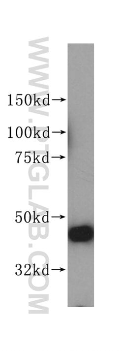 PGD Rabbit anti-Human, Mouse, Rat, Polyclonal, Proteintech 150 &mu;L; Unconjugated:Antibodies,
