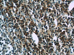 SKAP55 Rabbit anti-Human, Mouse, Rat, Polyclonal, Proteintech:Antibodies:Primary