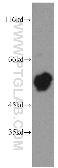 SKAP55 Rabbit anti-Human, Mouse, Rat, Polyclonal, Proteintech:Antibodies:Primary