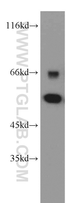 SKAP55 Rabbit anti-Human, Mouse, Rat, Polyclonal, Proteintech:Antibodies:Primary