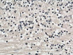 TMEM98 Rabbit anti-Human, Mouse, Polyclonal, Proteintech:Antibodies:Primary