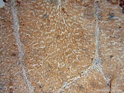 CYP27A1 Rabbit anti-Human, Mouse, Rat, Polyclonal, Proteintech:Antibodies:Primary
