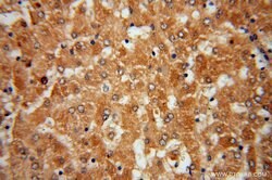 CYP27A1 Rabbit anti-Human, Mouse, Rat, Polyclonal, Proteintech:Antibodies:Primary