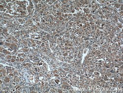 CYP27A1 Rabbit anti-Human, Mouse, Rat, Polyclonal, Proteintech:Antibodies:Primary