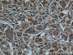 CYP27A1 Rabbit anti-Human, Mouse, Rat, Polyclonal, Proteintech:Antibodies:Primary