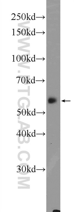CYP27A1 Rabbit anti-Human, Mouse, Rat, Polyclonal, Proteintech:Antibodies:Primary