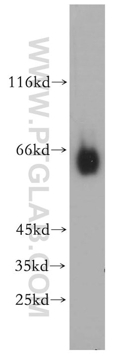 CYP27A1 Rabbit anti-Human, Mouse, Rat, Polyclonal, Proteintech:Antibodies:Primary