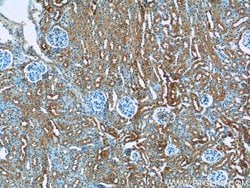 IVNS1ABP Rabbit anti-Human, Mouse, Rat, Polyclonal, Proteintech:Antibodies:Primary