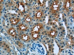 IVNS1ABP Rabbit anti-Human, Mouse, Rat, Polyclonal, Proteintech:Antibodies:Primary