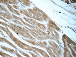 IVNS1ABP Rabbit anti-Human, Mouse, Rat, Polyclonal, Proteintech:Antibodies:Primary
