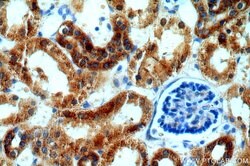 IVNS1ABP Rabbit anti-Human, Mouse, Rat, Polyclonal, Proteintech:Antibodies:Primary