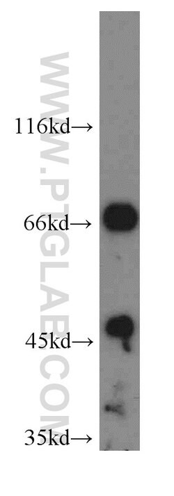 IVNS1ABP Rabbit anti-Human, Mouse, Rat, Polyclonal, Proteintech:Antibodies:Primary