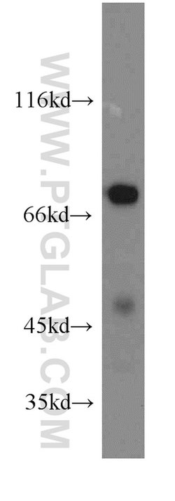 IVNS1ABP Rabbit anti-Human, Mouse, Rat, Polyclonal, Proteintech:Antibodies:Primary