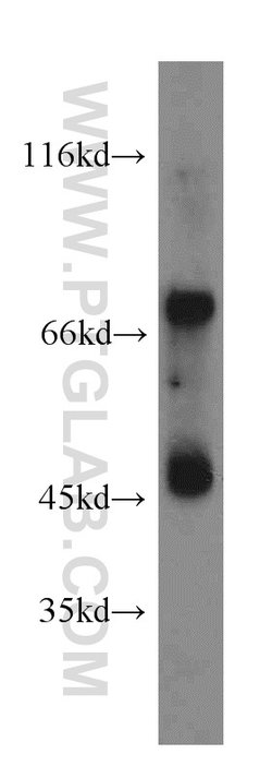 IVNS1ABP Rabbit anti-Human, Mouse, Rat, Polyclonal, Proteintech:Antibodies:Primary