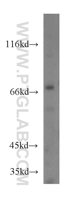 IVNS1ABP Rabbit anti-Human, Mouse, Rat, Polyclonal, Proteintech:Antibodies:Primary