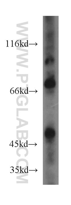 IVNS1ABP Rabbit anti-Human, Mouse, Rat, Polyclonal, Proteintech:Antibodies:Primary