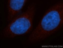 UQCRC2 Rabbit anti-Human, Mouse, Rat, Polyclonal, Proteintech:Antibodies:Primary