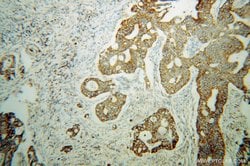UQCRC2 Rabbit anti-Human, Mouse, Rat, Polyclonal, Proteintech:Antibodies:Primary