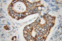 UQCRC2 Rabbit anti-Human, Mouse, Rat, Polyclonal, Proteintech:Antibodies:Primary