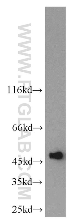 UQCRC2 Rabbit anti-Human, Mouse, Rat, Polyclonal, Proteintech:Antibodies:Primary