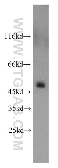UQCRC2 Rabbit anti-Human, Mouse, Rat, Polyclonal, Proteintech:Antibodies:Primary